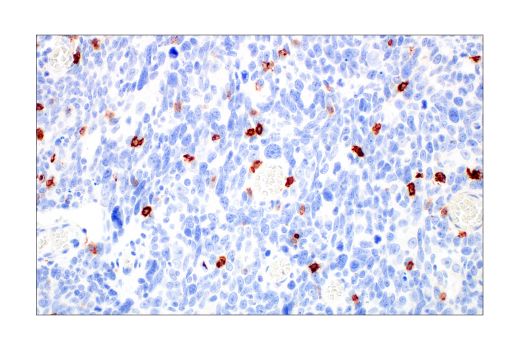 CD57 (HNK-1) Mouse mAb