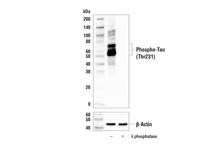 Phospho-Tau (Thr231) Antibody