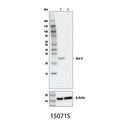 Bcl-2 (124) Mouse mAb