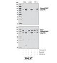 Cleaved PARP (Asp214) (D64E10) XP Rabbit mAb