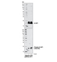 Phospho-4E-BP1 (Thr37/46) (236B4) Rabbit mAb
