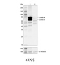 Lamin A/C (4C11) Mouse mAb