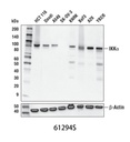 IKKα (D3W6N) Rabbit mAb