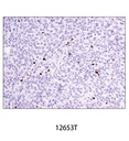 FoxP3 (D6O8R) Rabbit mAb