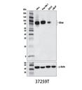 CD44 (E7K2Y) XP Rabbit mAb