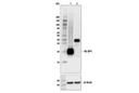 4E-BP1 (53H11) Rabbit mAb
