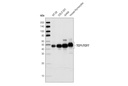 Wnt/β-Catenin Activated Targets Antibody Sampler Kit