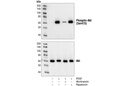 Phospho-Akt (Ser473) (193H12) Rabbit mAb