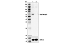 SQSTM1/p62 (D5E2) Rabbit mAb