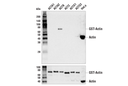 β-Actin (13E5) Rabbit mAb