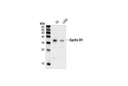 Cyclin D1 Antibody