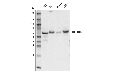 METTL14 (D8K8W) Rabbit mAb