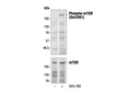 Phospho-mTOR (Ser2481) Antibody