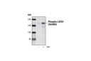 Phospho-LATS1 (Ser909) Antibody