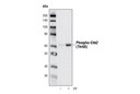 Phospho-Chk2 (Thr68) (C13C1) Rabbit mAb