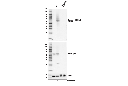 Phospho-SQSTM1/p62 (Ser349) (E7M1A) Rabbit mAb