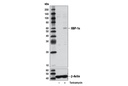 XBP-1s (D2C1F) Rabbit mAb