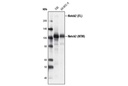 Notch2 (D76A6) XP Rabbit mAb