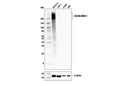 CD206/MRC1 (E2L9N) Rabbit mAb