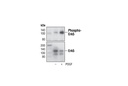 Phospho-Erk5 (Thr218/Tyr220) Antibody