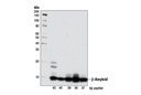 β-Amyloid (D54D2) XP Rabbit mAb