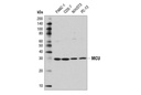 MCU (D2Z3B) Rabbit mAb