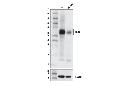 DLL3 (E3J5R) Rabbit mAb