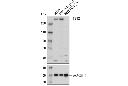 TET2 (D6B9Y) Rabbit mAb