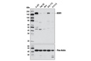 ASK1 (D11C9) Rabbit mAb