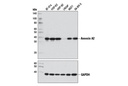 Annexin A2 (D11G2) Rabbit mAb