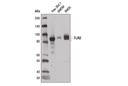 Toll-like Receptor 2 (E1J2W) Rabbit mAb (Mouse Specific)