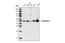 β-Arrestin 2 (C16D9) Rabbit mAb