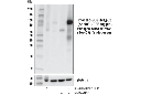 Phospho-SQSTM1/p62 (Ser403) (D8D6T) Rabbit mAb