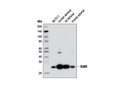 StAR (D10H12) XP Rabbit mAb
