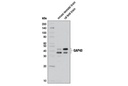 GAP43 (D9C8) Rabbit mAb