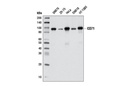 CD71 (D7G9X) XP Rabbit mAb