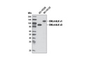 ALK (D5F3) XP Rabbit mAb