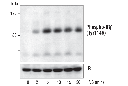 Phospho-IGF-I Receptor β (Tyr1131)/Insulin Receptor β (Tyr1146) Antibody
