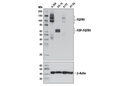FGF Receptor 1 (D8E4) XPRabbit mAb