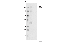 ZEB1 (D80D3) Rabbit mAb