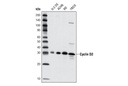 Cyclin D2 (D52F9) Rabbit mAb