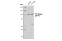 PI3 Kinase p110 δ (D1Q7R) Rabbit mAb