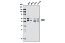 PDK1 (D37A7) Rabbit mAb