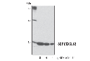 SDF1/CXCL12 (D32F9) Rabbit mAb