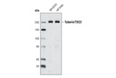 Tuberin/TSC2 (D93F12) XP Rabbit mAb