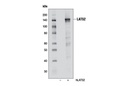 LATS2 (D83D6) Rabbit mAb