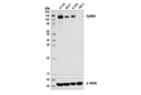 EphB4 (D1C7N) Rabbit mAb