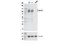 DNMT3B (E4I4O) Rabbit mAb (Mouse Specific)
