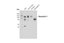 Neuropilin-1 (D62C6) Rabbit mAb