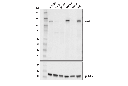 Jak2 (E4Y4D) Mouse mAb